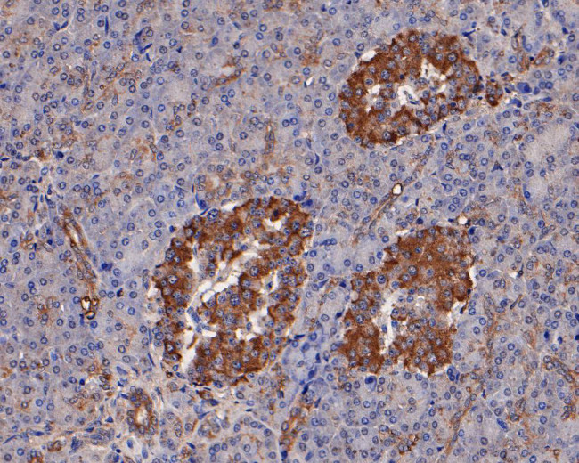 ATGL Antibody in Immunohistochemistry (Paraffin) (IHC (P))