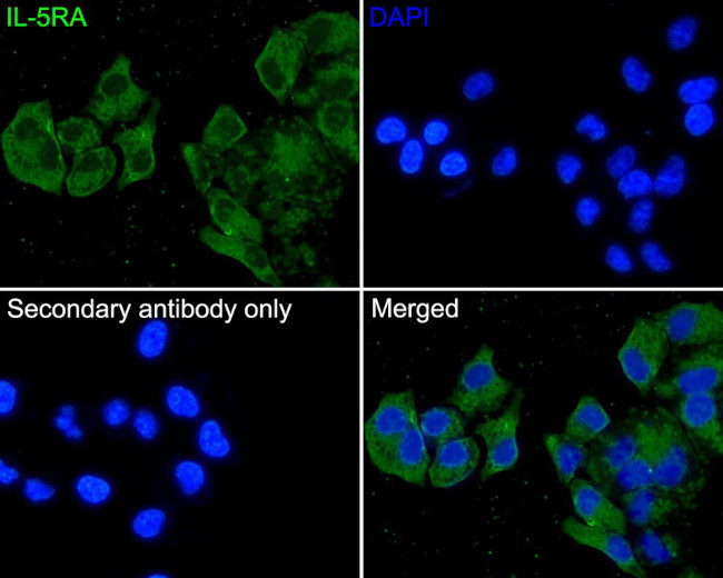 IL5RA Antibody in Immunocytochemistry (ICC/IF)