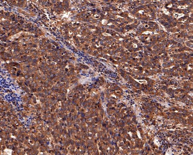 IL5RA Antibody in Immunohistochemistry (Paraffin) (IHC (P))