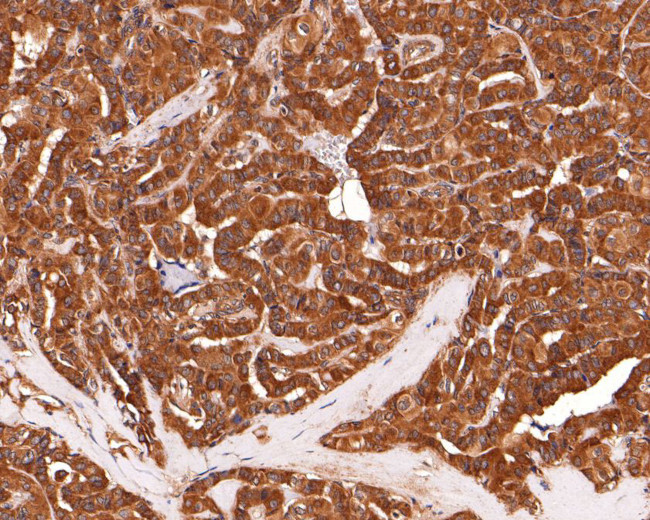 IL5RA Antibody in Immunohistochemistry (Paraffin) (IHC (P))