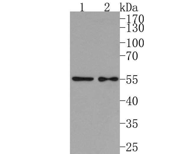 IL5RA Antibody in Western Blot (WB)