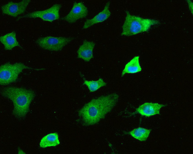 MMP7 Antibody in Immunocytochemistry (ICC/IF)