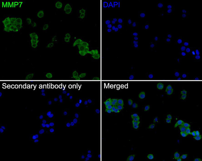 MMP7 Antibody in Immunocytochemistry (ICC/IF)