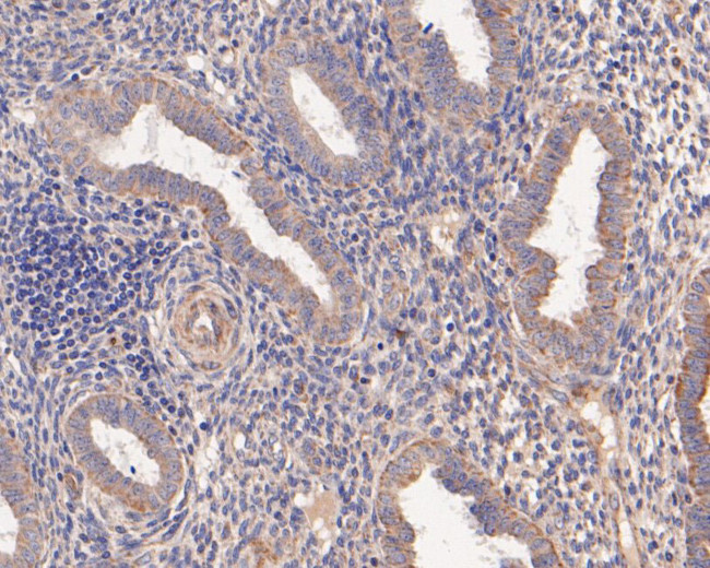 MMP7 Antibody in Immunohistochemistry (Paraffin) (IHC (P))