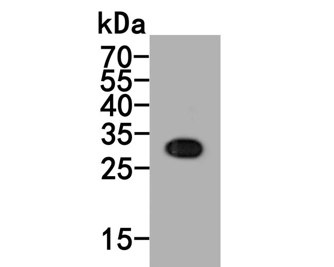 MMP7 Antibody in Western Blot (WB)