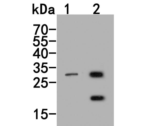 MMP7 Antibody in Western Blot (WB)