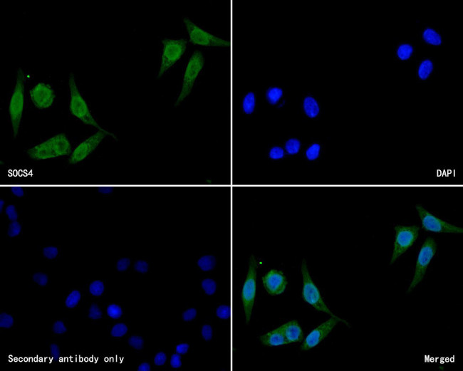 SOCS4 Antibody in Immunocytochemistry (ICC/IF)