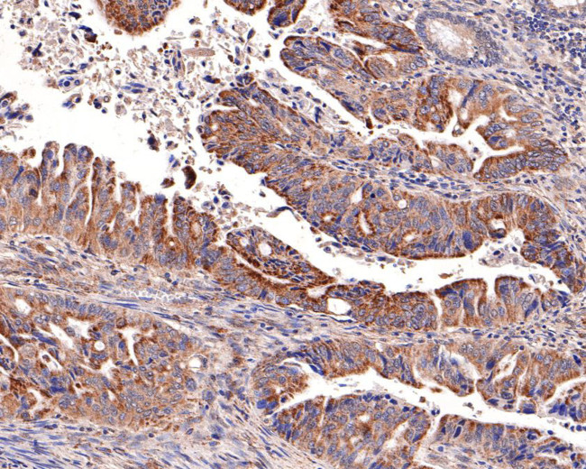 SOCS4 Antibody in Immunohistochemistry (Paraffin) (IHC (P))