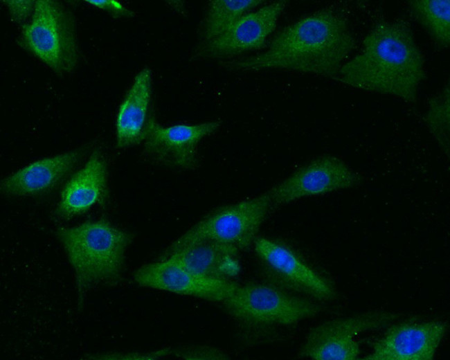 GRK3 Antibody in Immunocytochemistry (ICC/IF)