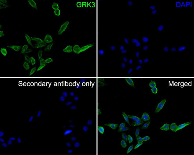 GRK3 Antibody in Immunocytochemistry (ICC/IF)