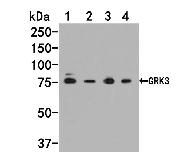 GRK3 Antibody in Western Blot (WB)