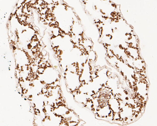 FAB1A Antibody in Immunohistochemistry (Paraffin) (IHC (P))