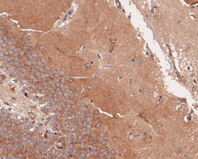 B3GAT1 Antibody in Immunohistochemistry (Paraffin) (IHC (P))