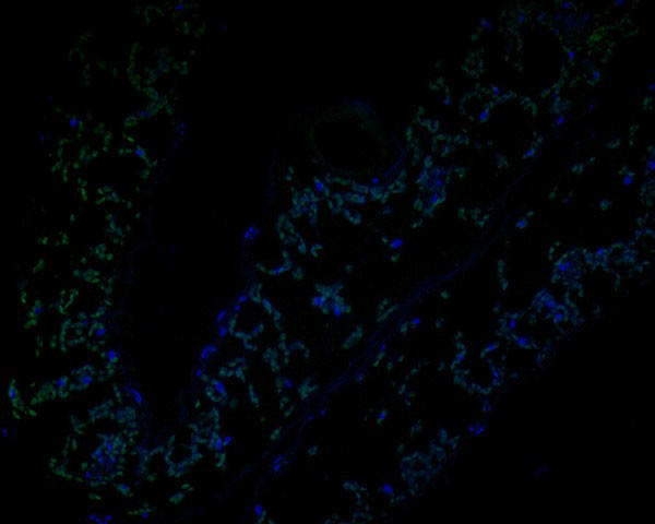 AP4M1 Antibody in Immunohistochemistry (Paraffin) (IHC (P))