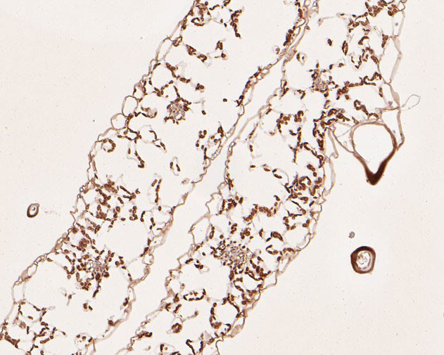 AP4M1 Antibody in Immunohistochemistry (Paraffin) (IHC (P))