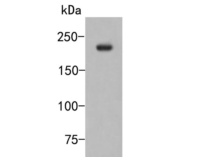 CNOT1 Antibody in Western Blot (WB)