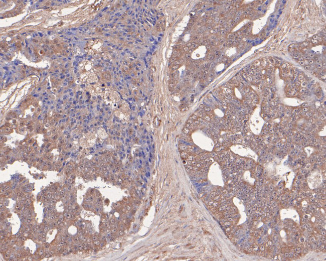 PFKP Antibody in Immunohistochemistry (Paraffin) (IHC (P))