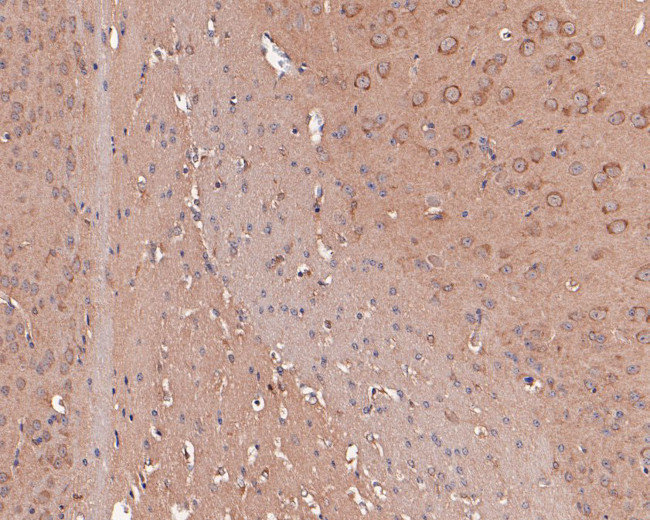 PFKP Antibody in Immunohistochemistry (Paraffin) (IHC (P))