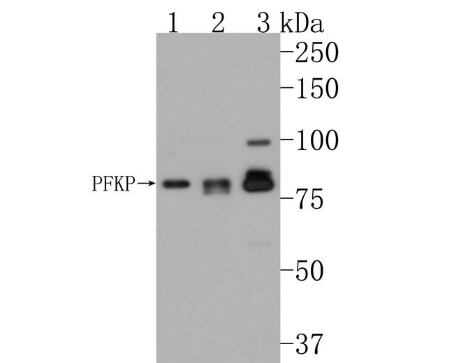 PFKP Antibody in Western Blot (WB)