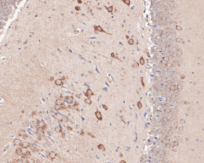 GABRA6 Antibody in Immunohistochemistry (Paraffin) (IHC (P))