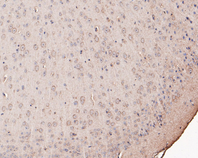 GABRA6 Antibody in Immunohistochemistry (Paraffin) (IHC (P))