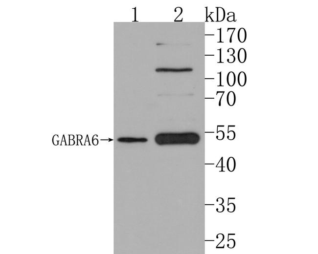 GABRA6 Antibody in Western Blot (WB)