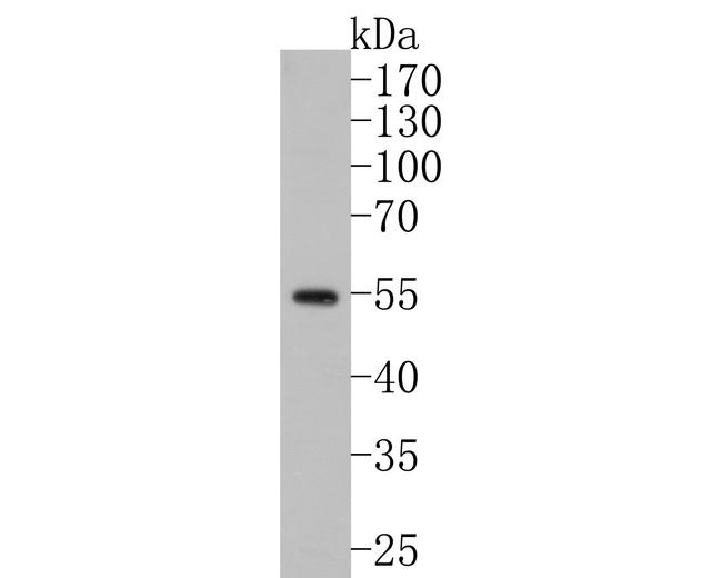 GABRA6 Antibody in Western Blot (WB)