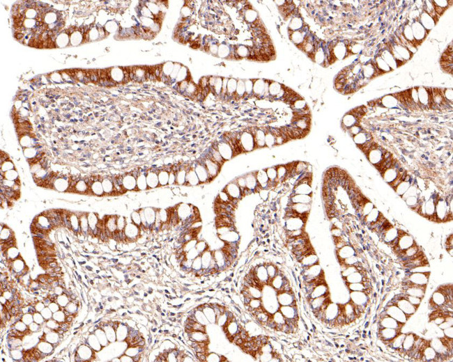 P-Glycoprotein Antibody in Immunohistochemistry (Paraffin) (IHC (P))