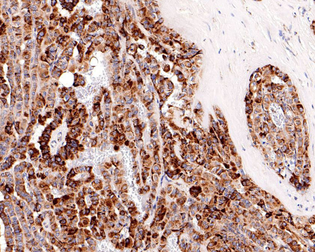 P-Glycoprotein Antibody in Immunohistochemistry (Paraffin) (IHC (P))