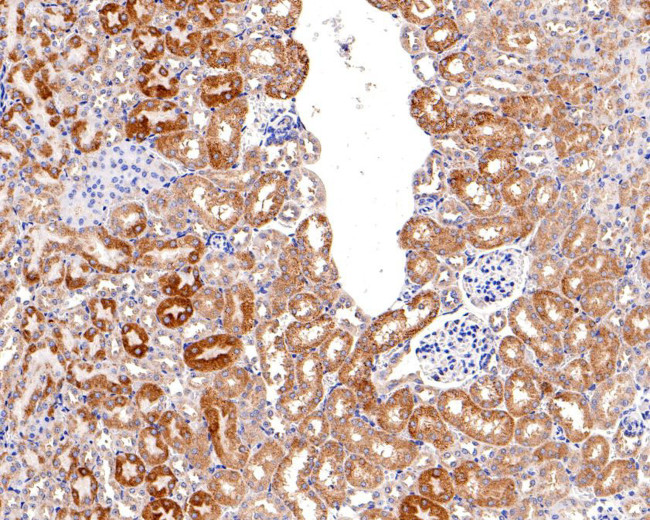 P-Glycoprotein Antibody in Immunohistochemistry (Paraffin) (IHC (P))