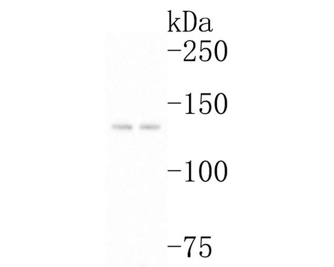 P-Glycoprotein Antibody in Western Blot (WB)