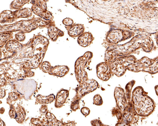 TIF1 gamma Antibody in Immunohistochemistry (Paraffin) (IHC (P))