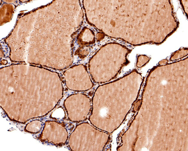 TIF1 gamma Antibody in Immunohistochemistry (Paraffin) (IHC (P))