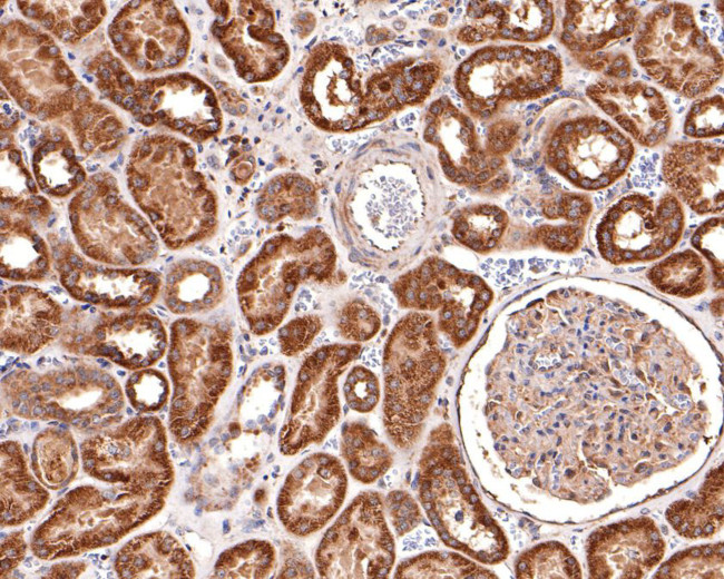 AP2A2 Antibody in Immunohistochemistry (Paraffin) (IHC (P))