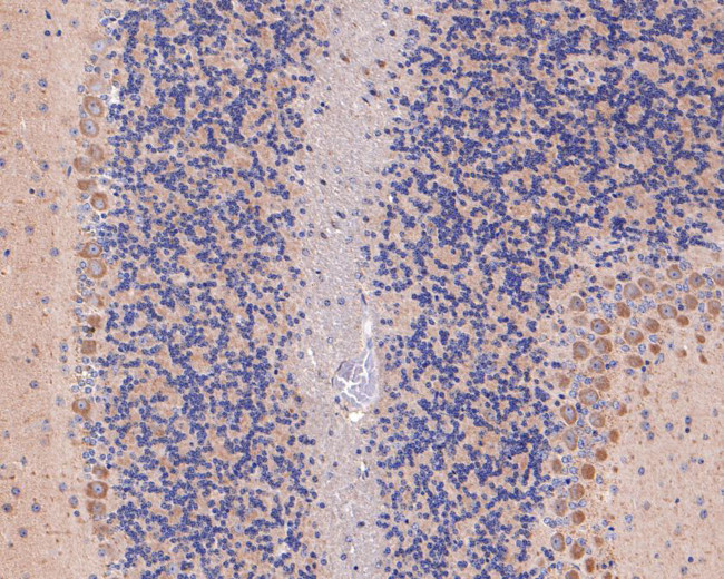 AP2A2 Antibody in Immunohistochemistry (Paraffin) (IHC (P))