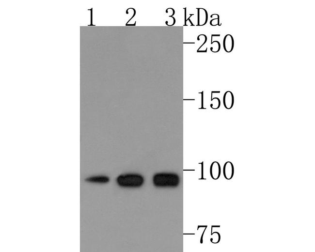 AP2A2 Antibody in Western Blot (WB)