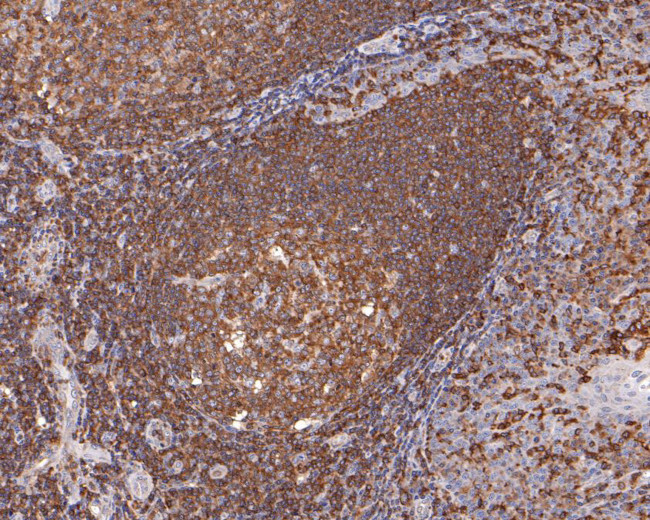 WASP Antibody in Immunohistochemistry (Paraffin) (IHC (P))