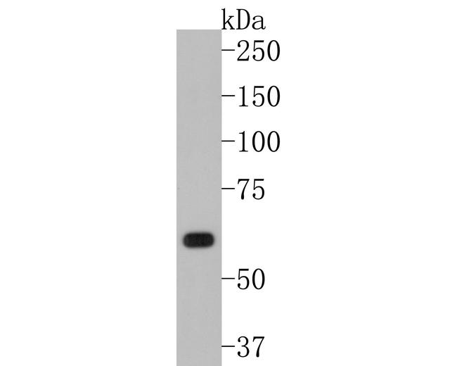 WASP Antibody in Western Blot (WB)