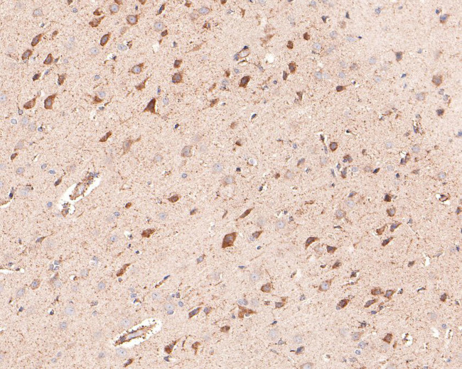 CNGA3 Antibody in Immunohistochemistry (Paraffin) (IHC (P))