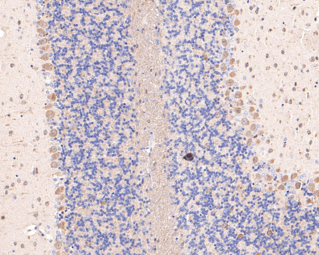 DACT1 Antibody in Immunohistochemistry (Paraffin) (IHC (P))