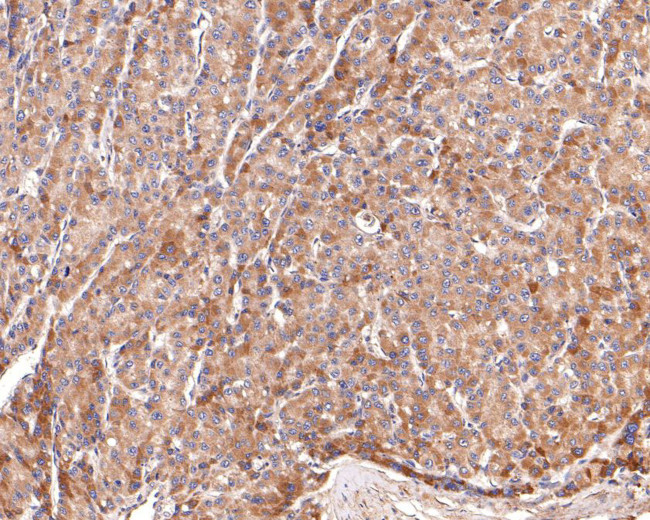 AOX1 Antibody in Immunohistochemistry (Paraffin) (IHC (P))