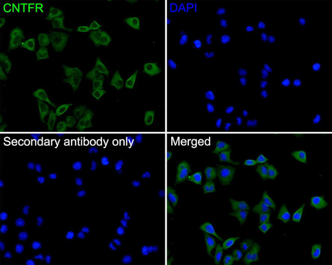 CNTFR Antibody in Immunocytochemistry (ICC/IF)