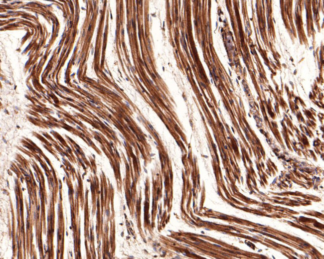 CNTFR Antibody in Immunohistochemistry (Paraffin) (IHC (P))