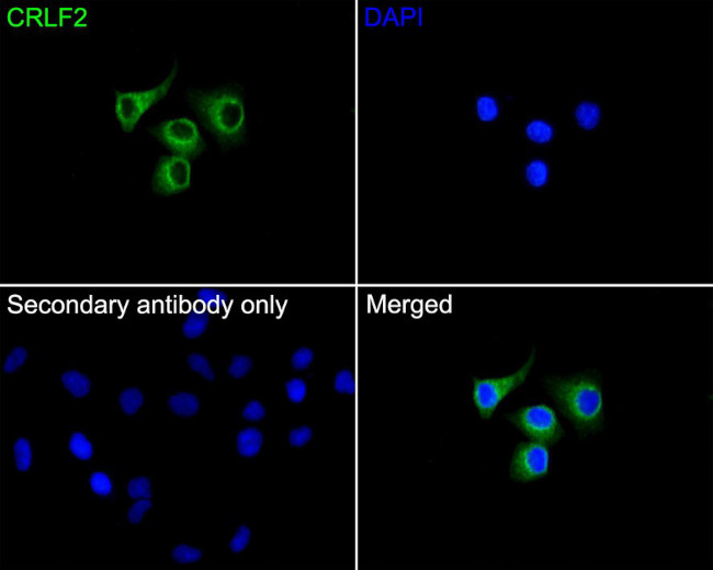 TSLP Receptor Antibody in Immunocytochemistry (ICC/IF)