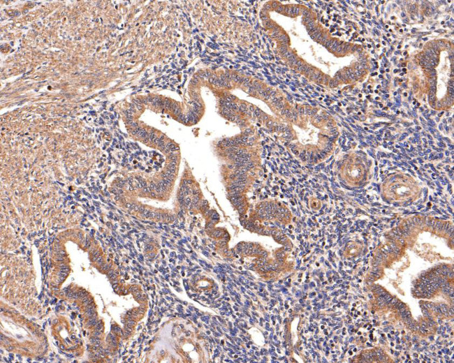 TSLP Receptor Antibody in Immunohistochemistry (Paraffin) (IHC (P))