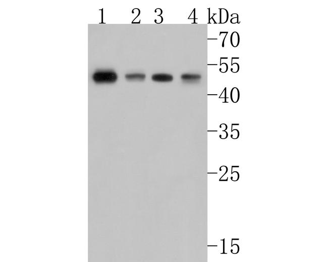 TSLP Receptor Antibody in Western Blot (WB)