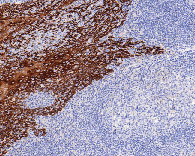 Cytokeratin 5/6 Antibody in Immunohistochemistry (Paraffin) (IHC (P))