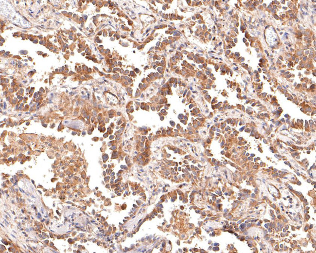 Cytokeratin 5/6 Antibody in Immunohistochemistry (Paraffin) (IHC (P))