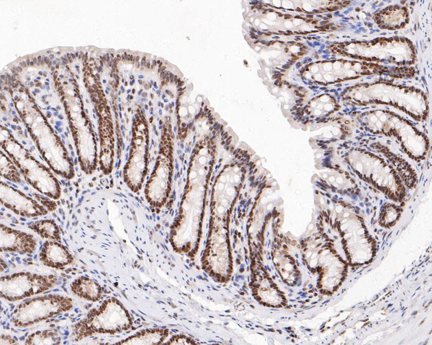 HMGB2 Antibody in Immunohistochemistry (Paraffin) (IHC (P))