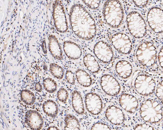 HMGB2 Antibody in Immunohistochemistry (Paraffin) (IHC (P))